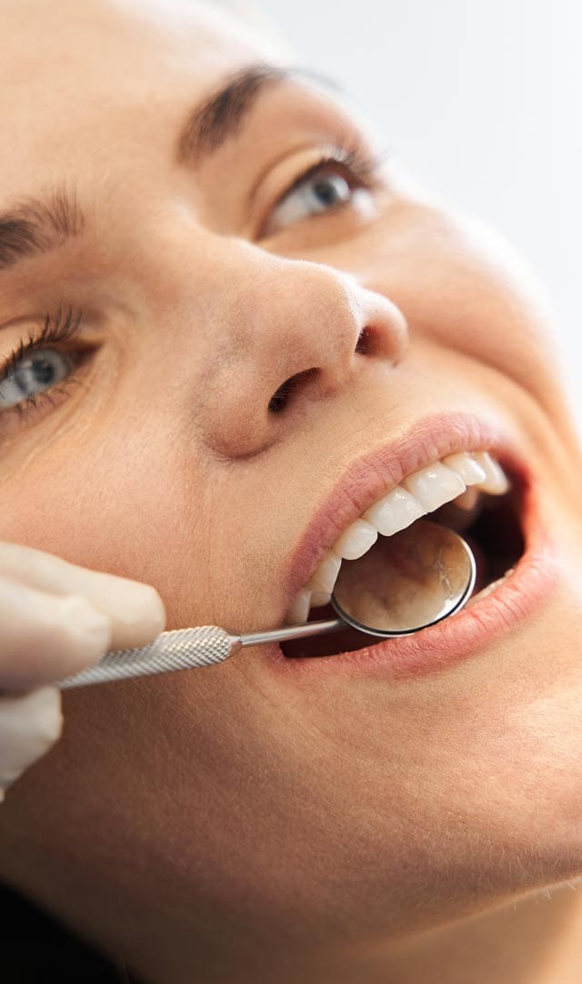 Geans Clinic - Periodontitis Concern Details