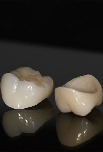 Geans Clinic - About Crowns