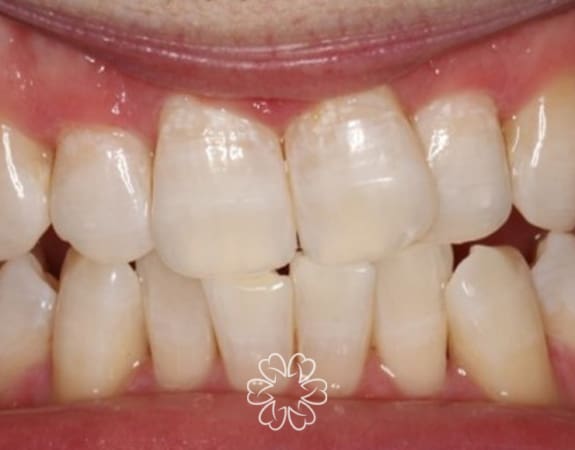 Geans Clinic - Airflow Patient After