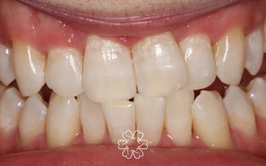 Geans Clinic - Airflow Patient After