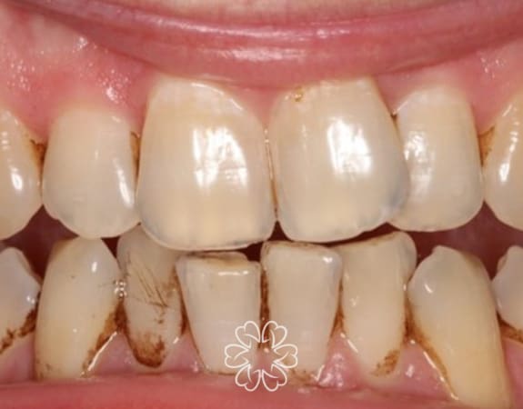 Geans Clinic - Airflow Patient Before