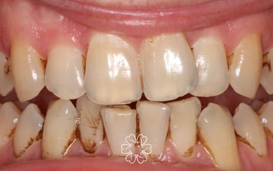 Geans Clinic - Airflow Patient Before