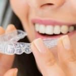 Geans Clinic - Clear Aligners Invisalign - Angel Aligners