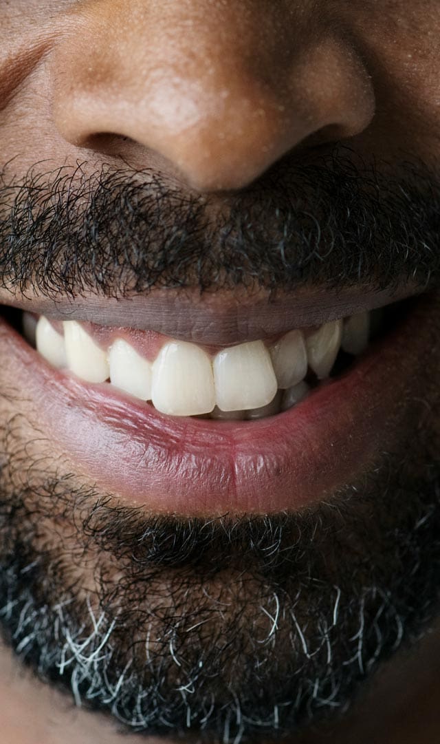 Geans Clinic - Crooked Teeth Concern Details