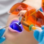 Geans Clinic - Fillings