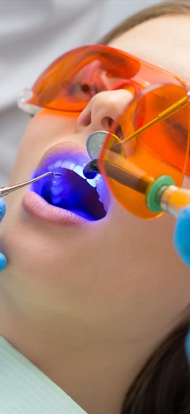 Geans Clinic - Fillings