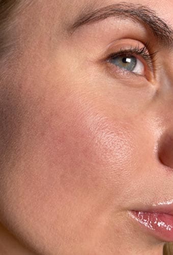 Geans Clinic - Skin Boosters About