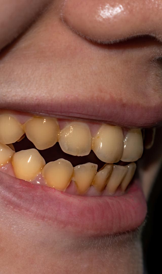 Geans Clinic - Tooth Discolouration Concern Details
