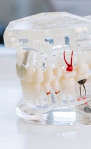 Geans Clinic - Prosthodontics Price List